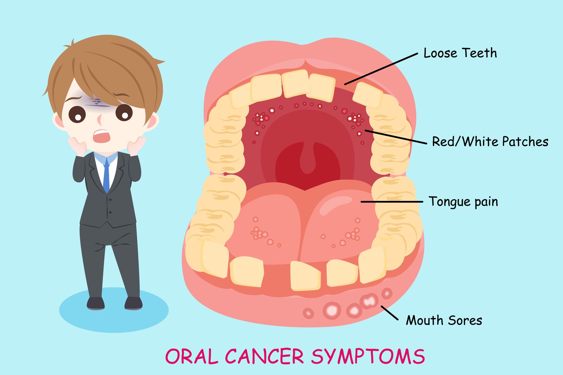 oral cancer symptoms